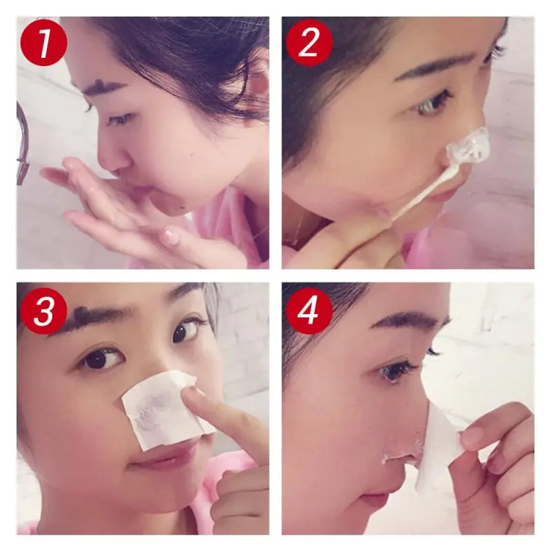 LANBENA's Suction Blackhead Remover