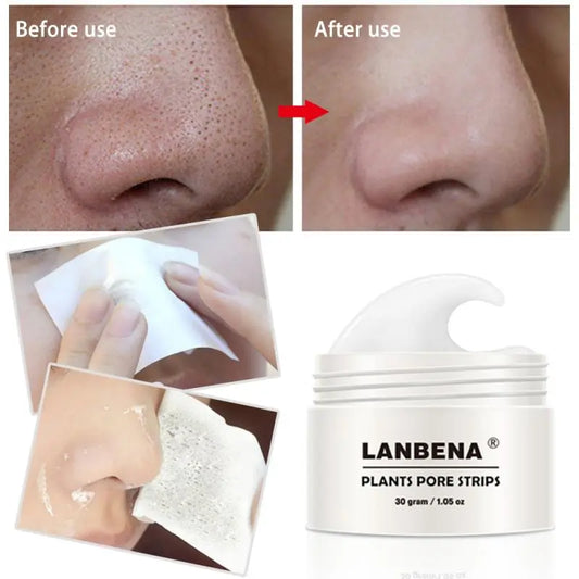 LANBENA's Suction Blackhead Remover