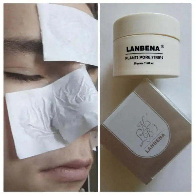 LANBENA's Suction Blackhead Remover